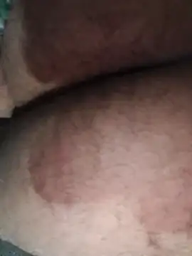 mirapito