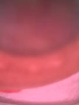luna_pinky