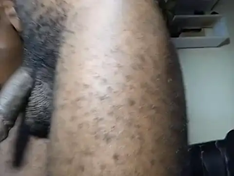 Moteroxz
