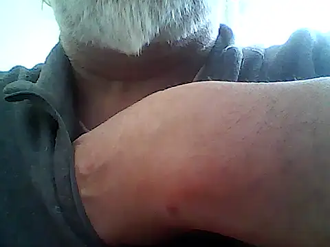 xcimeru